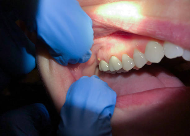 Best Emergency Cosmetic Dentistry in Mount Vernon, TX