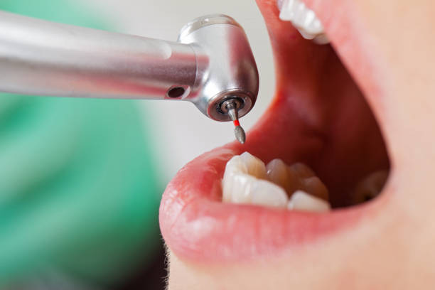 Best Emergency Dental Services for Seniors in Mount Vernon, TX
